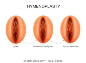হাইমেন এর চিত্র