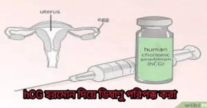 hCG হরমোন দিয়ে ডিম্বাণু পরিপক্ক করা