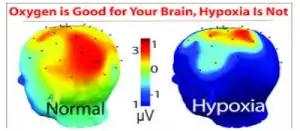 উচ্চতায় অজ্ঞান হওয়া