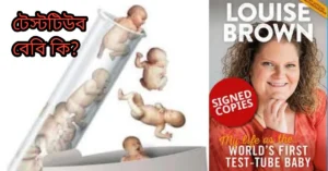 টেস্ট টিউব বেবি কি?টেস্টটিউব বেবি কিভাবে হয়?