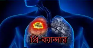 প্রি-ক্যান্সার
