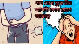 পাদ রোগের লক্ষণ নির্দেশ করে