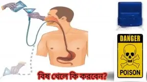 বিষ খাওয়ার প্রাথমিক চিকিৎসা!কেউ বিষ খেলে কি করবেন?