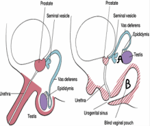 মেয়ে থেকে ছেলে হওয়ার কারণ